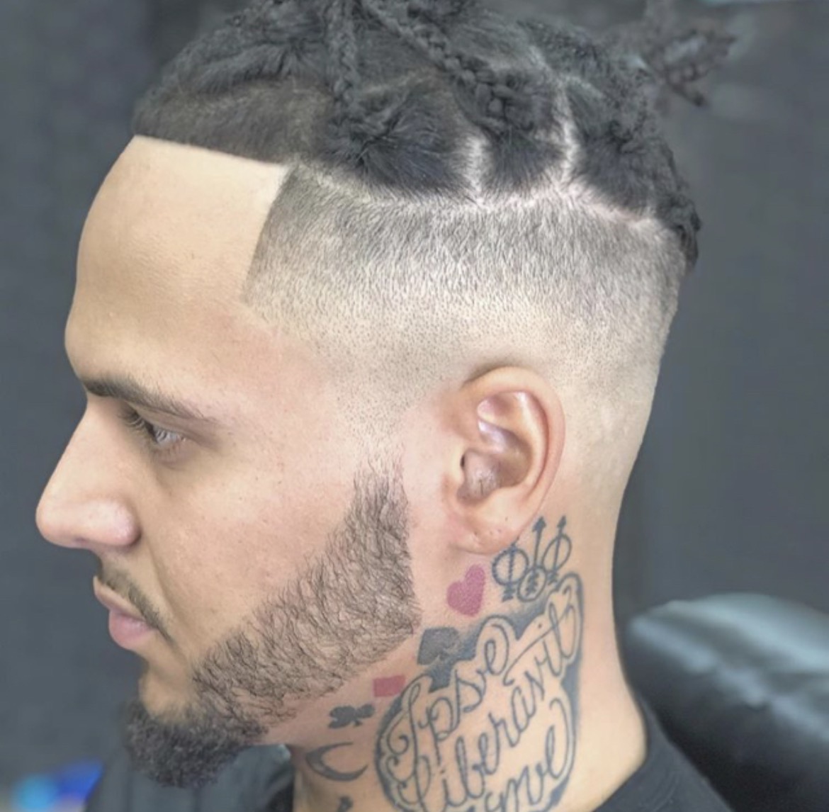 Braids with high skin fade and surgical part